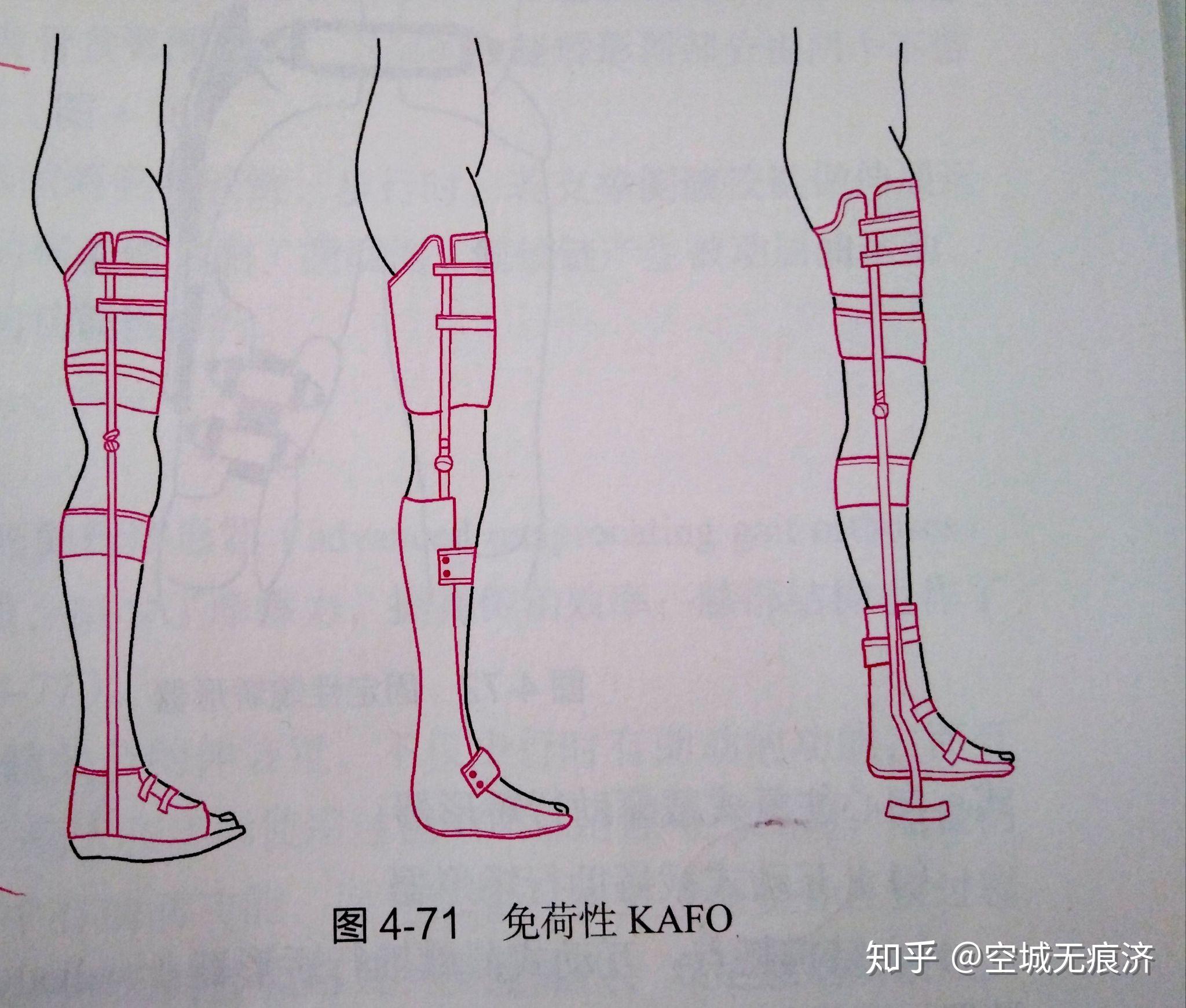臨床康復工程學 假肢與矯形器的功能、設計與發展